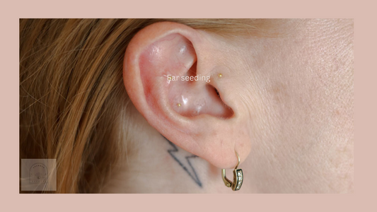 How eerseeding looks on the ear